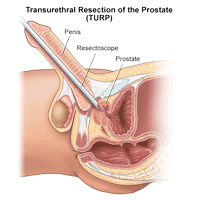 Cherry P. reccomend Orgasm through prostate