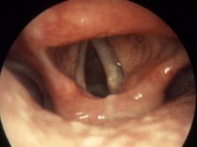How far can you deepthroat