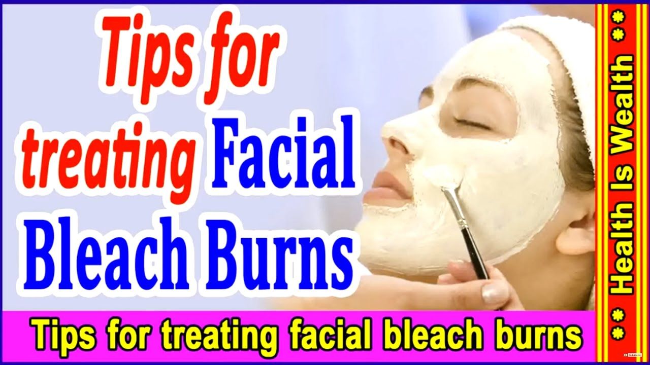 best of Healing remedies burn Facial