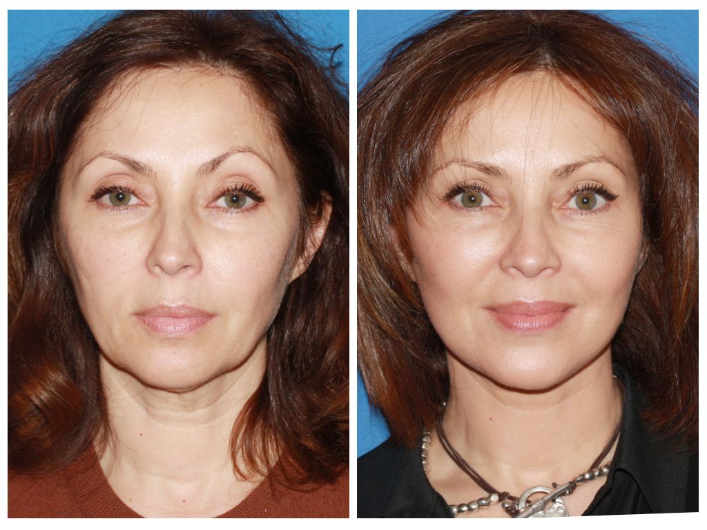 Sunflower reccomend Cosmetic surgery facial reconstruction