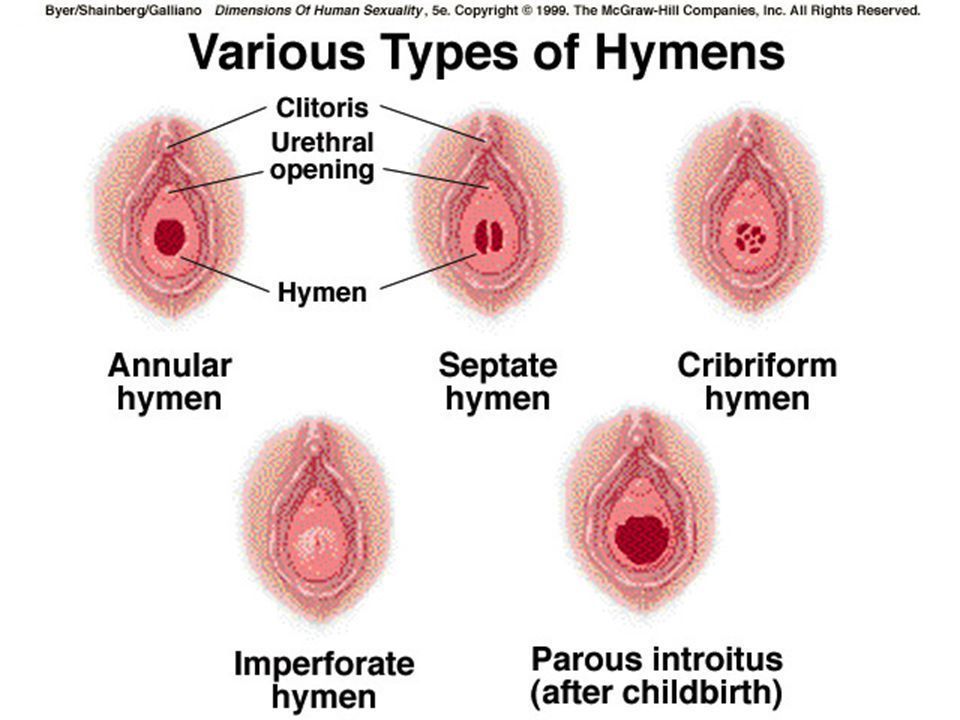 Cyst beside clitoris