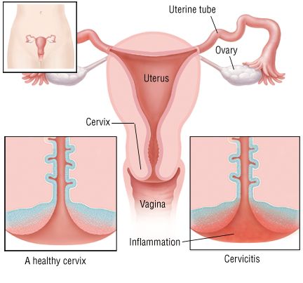 best of Hyc for vagina infections Doxycycle