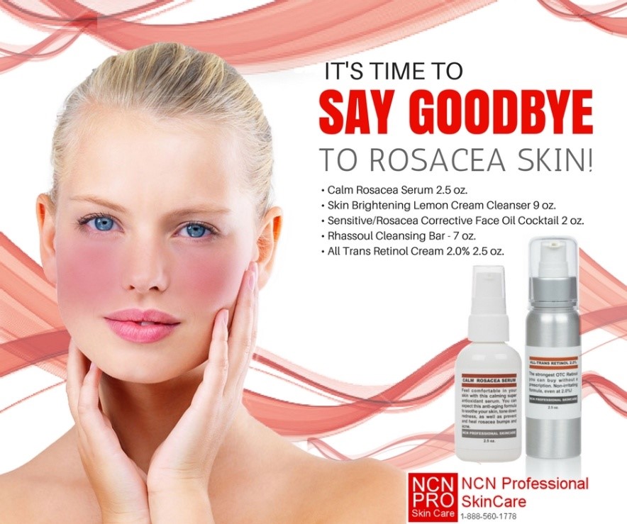 best of Help to Facial rosacea cream