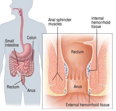 best of Symptoms in Medical anus tightness