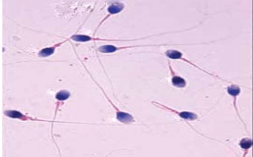Human sperm pics
