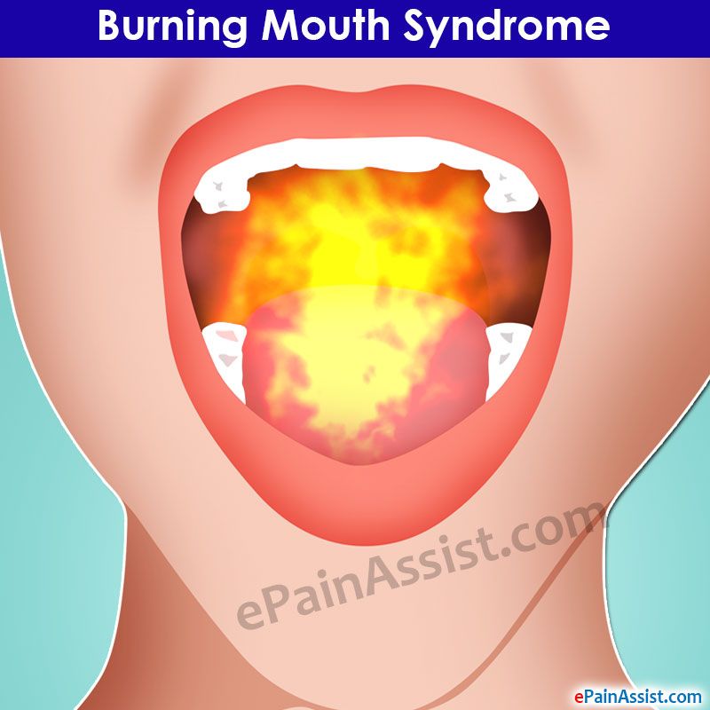 Gumby reccomend Burning tongue and sore throat