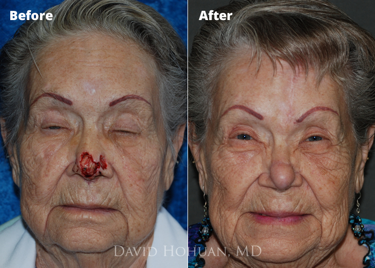 best of Surgery facial reconstruction Cosmetic