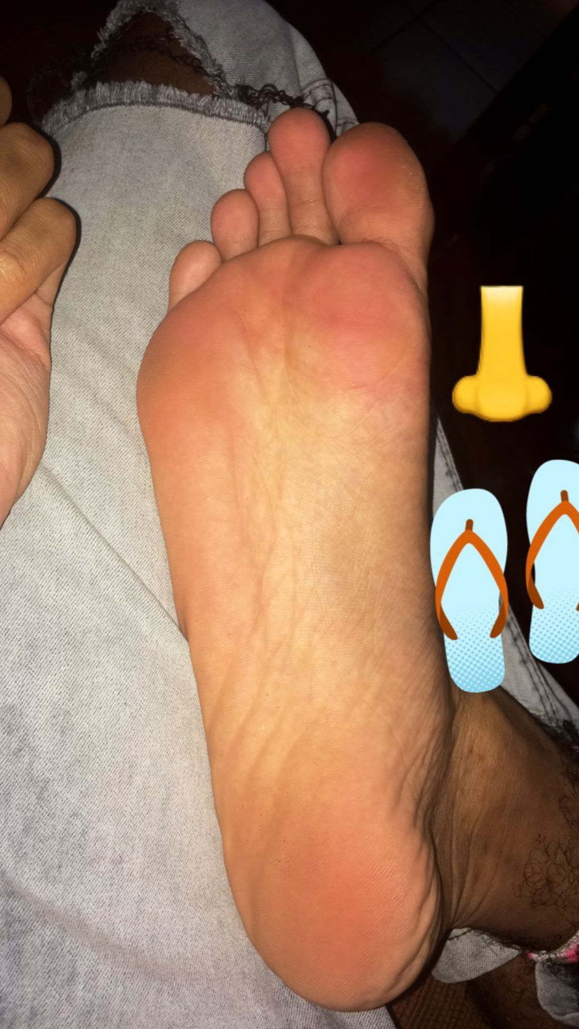 Foot and ankle ass