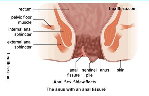 Someone get pregnant from anal sex