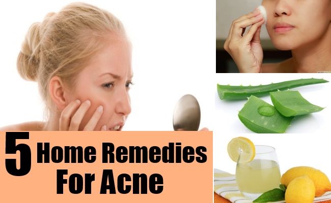 Uhura reccomend Facial acne home remedies