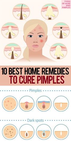 JK reccomend Facial acne home remedies