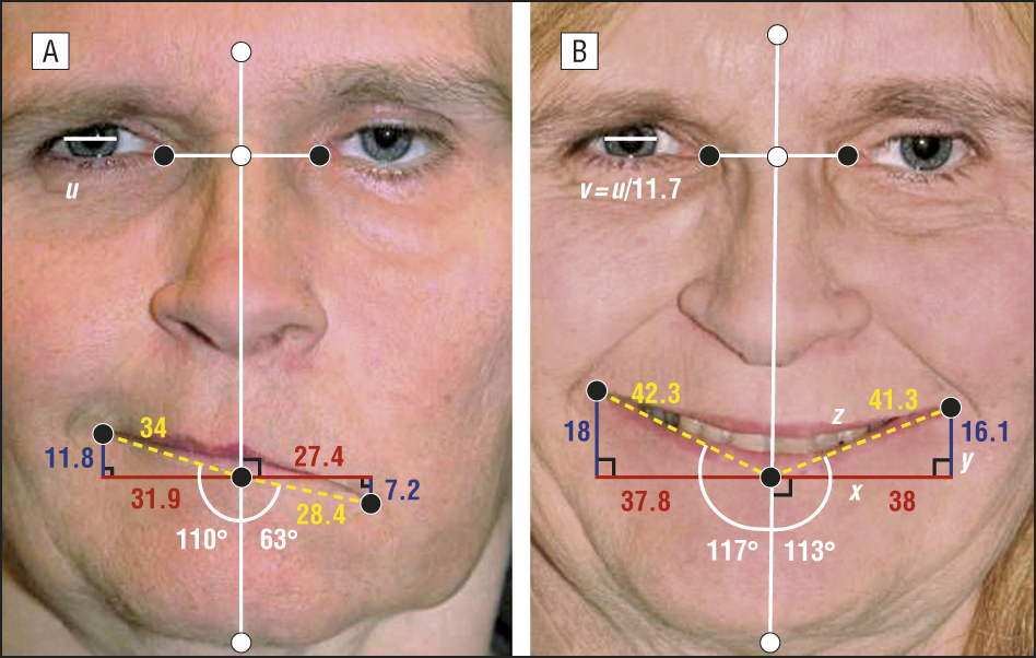best of Measurement Facial symmetry