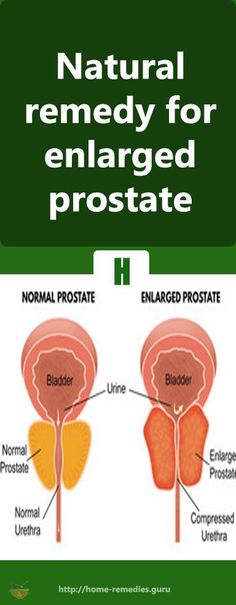 Prostate orgasm electrode home made