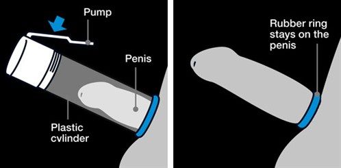 best of Your hand Make penis pump own