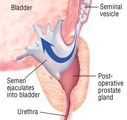 Handyman reccomend Orgasm through prostate