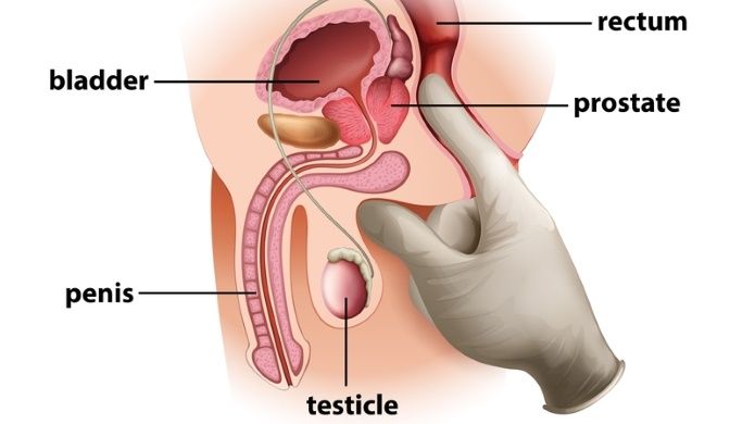 Barrel reccomend Prostate orgasim sex