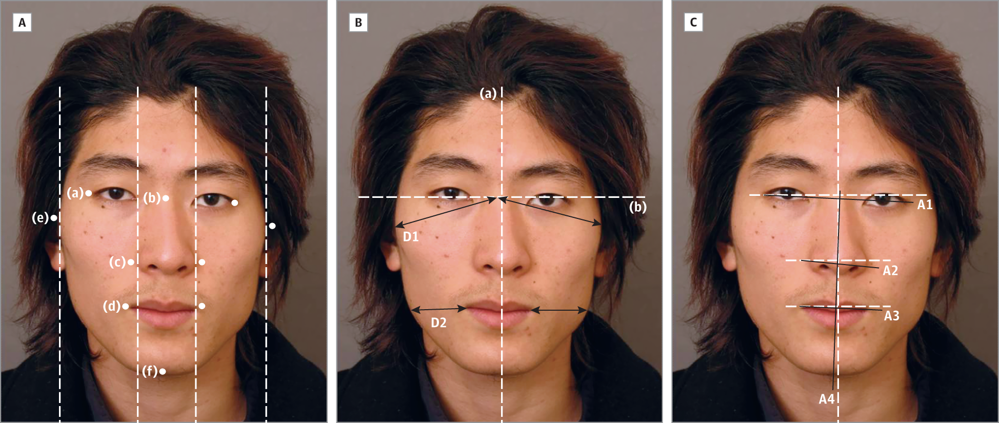 Yak reccomend Rate facial symmetry