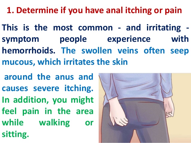 best of Itchy anus for Reasons