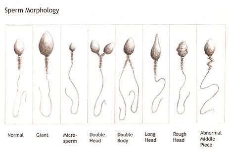 Sperm fertility clinic