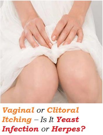 best of Itching clitoris Yeast infection